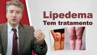 Tratamento de Lipedema Tem tratamento [upl. by Nylirehs]