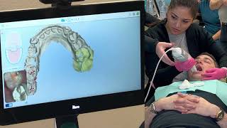 iTero Dental 3D Scan￼ [upl. by Brock]