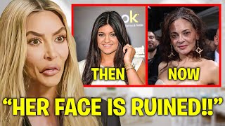 Kim Kardashian EXPOSES Kylie Jenner’s BOTCHED Plastic Surgery [upl. by Eibrab108]