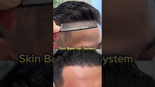 Skin Base Hair Patch System I 100  Natural Look hairreplacement hairsystem [upl. by Brenan87]