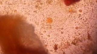 Entamoeba histolyticaEH Quadrinucleated Cyst in Iodine wet mount [upl. by Pressey]