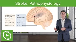 Stroke Pathophysiology  Clinical Neurology [upl. by Gaul968]