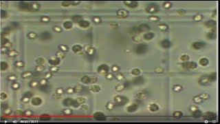 How to count Rbcs amp Wbcs content using Hemocytometer [upl. by Enyawed]