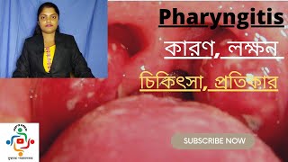 Pharyngitis In Bangla  Causes  Treatments  Home Remedies [upl. by Juxon366]