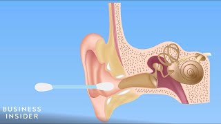 Forget QTips — Here’s How You Should Be Cleaning Your Ears [upl. by Yasmeen]