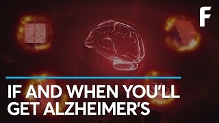 The Most Valuable Alzheimers Test Created So Far [upl. by Eigna]