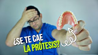 ¿TU PRÓTESIS DENTAL SE MUEVE😞 ¡Deberías ver este vídeo🤩 [upl. by Merta]