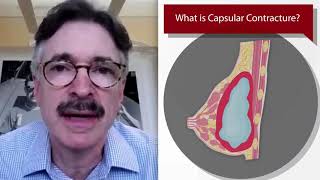 Ways to Treat Capsular Contracture Plastic Surgery Hot Topics  Drs Rohrich Hidalgo amp Weinstein [upl. by Walczak]