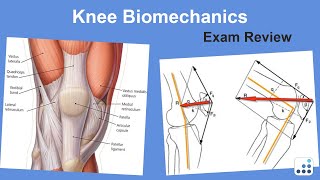 Traumatic Knee Dislocation ReductionQuick Version [upl. by Melicent]