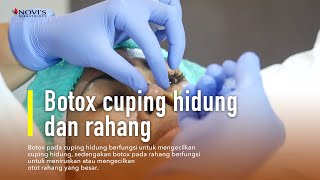 PROSES BOTOX RAHANG DAN CUPING HIDUNG [upl. by Sloan]