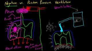 Negative vs Positive Pressure Ventilation [upl. by Ahsilrak]