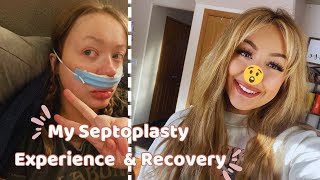 Septoplasty Recovery Blog and Storytime My Sinus Surgery Experience [upl. by Nilesoy699]