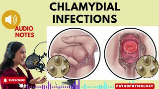 Chlamydia Infections Causes Symptoms and Treatment Options Audio Notes [upl. by Schug110]