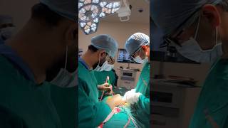 Spine Surgery Live 😲 [upl. by Phebe]