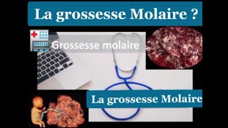 Tableau Médical 06  La Grossesse Molaire [upl. by Cordle]