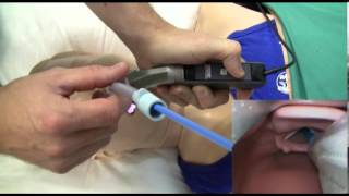 Direct amp Video Laryngoscopy [upl. by Bronson164]