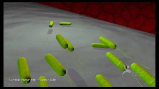 What Are Bacterial Biofilms A Six Minute Montage [upl. by Nancy]