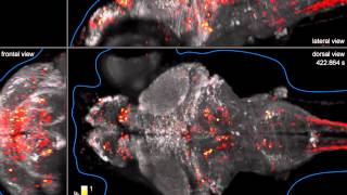 Wholebrain imaging of neuronal activity in a larval zebrafish [upl. by Aidin]