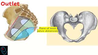 Maternal obstetric diameters [upl. by Sheldon]