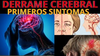 🧠8 Señales de alerta de un Derrame Cerebral ¿Sabes reconocerlas [upl. by Rayburn]