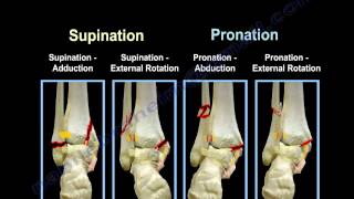 Ankle Fractures Lauge Hansen Introduction  Everything You Need To Know  Dr Nabil Ebraheim [upl. by Ahsenar]