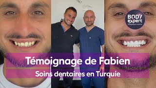 CLINIQUE DENTAIRE EN TURQUIE  🦷 Témoignage Fabien  20 couronnes Emax  gummy smile  BODYEXPERT [upl. by Tilden]