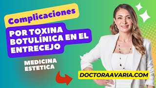 Complicaciones de la Toxina Botulínica en el Entrecejo [upl. by Dorsman]