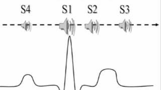 fourth heart sound s4 [upl. by Yeniffit972]