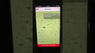 YO sperm test semen by iPhone [upl. by Farrel]