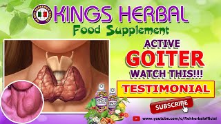 Active Goiter  KINGS Herbal Testimonial [upl. by Alyk2]