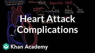 Complications after a heart attack myocardial infarction  NCLEXRN  Khan Academy [upl. by Zeni]