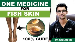 One Medicine To Cure Ichthyosis Vulgaris FISH SKIN  How to Cure FISH SKIN Naturally amp Permanently [upl. by Allicsirp520]