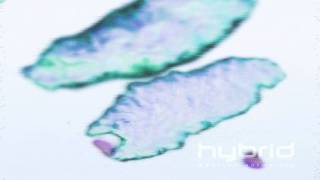 Macrophages engulfing pathogens Hybrid Medical Animation HD [upl. by Aimil]