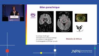 Comment la maladie de Wilson interrogetelle les neurosciences et l’interaction organescerveau [upl. by Eannyl]