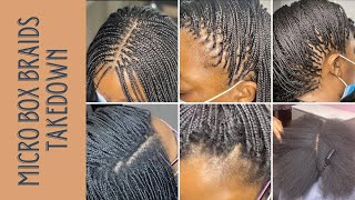 Micro Box Braids TAKEDOWN After 4 MONTHS [upl. by Renato]