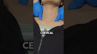 How to Perform Lymphatic Massage After Chin Liposuction [upl. by Aitsirhc]