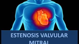 Estenosis valvular mitral  Fisiopatología [upl. by Samot]