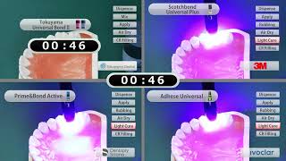 Direct restoration UNIVERSAL BOND II in comparison  TOKUYAMA DENTAL [upl. by Alyce]