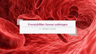 Glucose Sensor anbringen von Freestyle Libre Abott [upl. by Enala33]