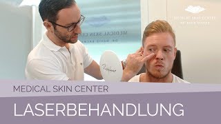 Laserbehandlung im Medical Skin Center – Dr Bacman [upl. by Jacinda]