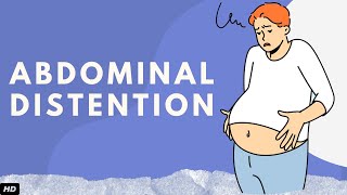 Abdominal Distention Everything You Need To Know [upl. by Britney]