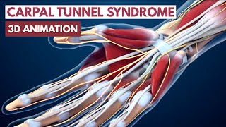 Carpal Tunnel Syndrome l 3D Animation [upl. by Gertie]