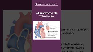 El síndrome de takotsubo🫀👀 cardiologia corazon clinicampj elsalvador viral parati [upl. by Ytissac]