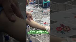 Spasticity is Velocity Dependent  Practical Demonstration [upl. by Welbie]