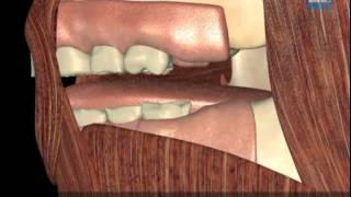 How Myobrace Works What are the causes of crooked teeth Myobrace [upl. by Lowney]