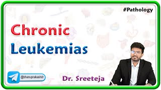 17 Chronic Leukemias  CML and CLL  USMLE Step 1 Pathology [upl. by Luoar97]