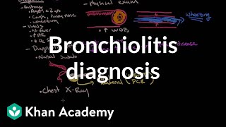 Bronchiolitis diagnosis  Respiratory system diseases  NCLEXRN  Khan Academy [upl. by Parrnell216]