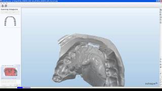 Abdruck Impression Scannen im 3shape DentalSystem  powered by WIELAND [upl. by Ayahsey]