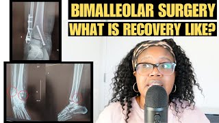 I BROKE MY ANKLE WHILE BOWLING My surgery recovery [upl. by Ard]