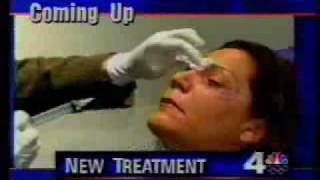 Botox Injections Can Cure Puffy Eyes [upl. by Aronow]